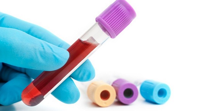 Анализ крови на паразитарные инфекции: что нужно знать?