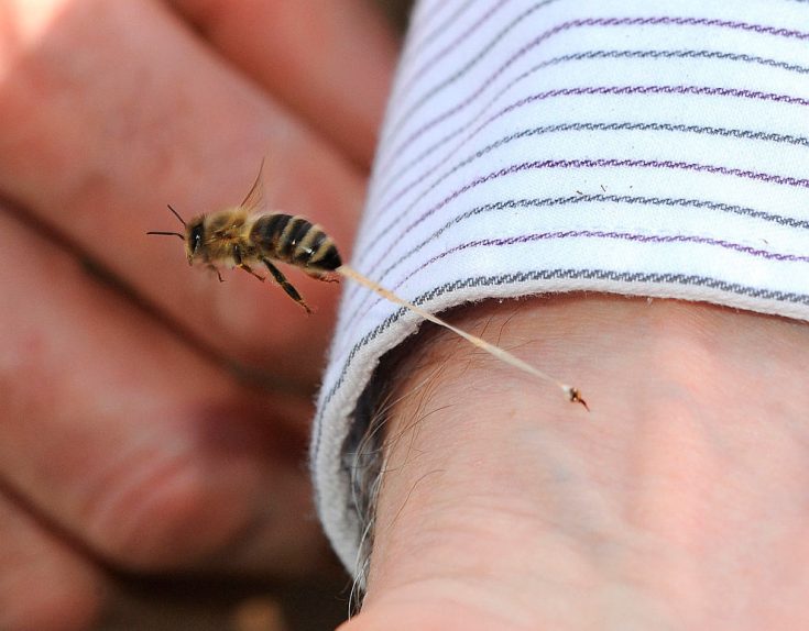 Что делать, если укусит пчела?