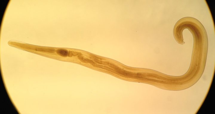 Какие черви живут в организме человека