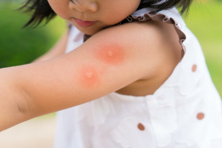 Лучший репеллент от комаров для детей