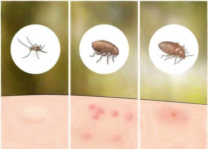 Пятна и высыпания на теле, похожие на укусы комаров